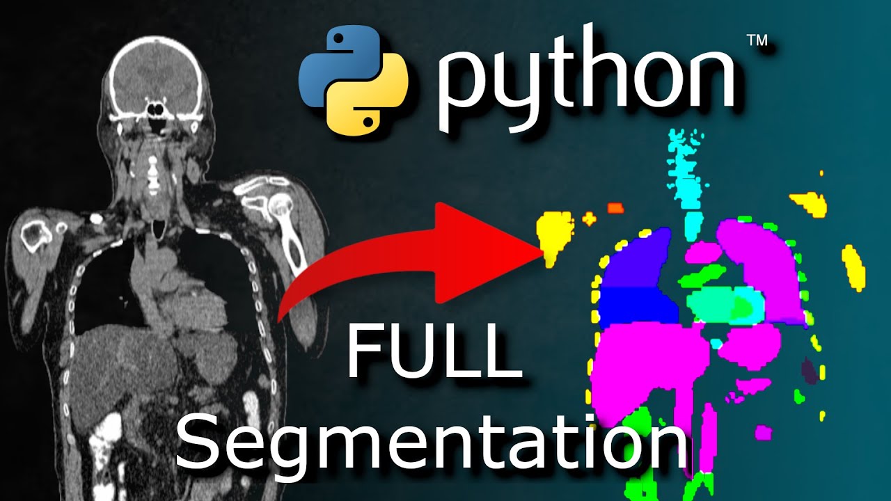 Python AI Organ Segmentation Tutorial